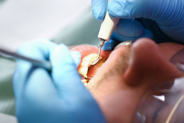 Best Emergency Dental Care for Trauma or Injury in Mvern, AL